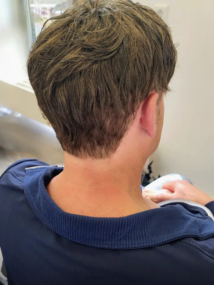 The same HEADS client after his hair system — full coverage and a natural nape, seen from behind